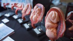Over 41 million babies were terminated through abortion in 2018