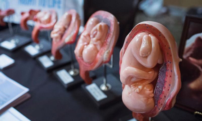 Over 41 million babies were terminated through abortion in 2018