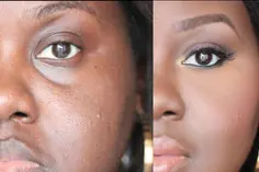How to conceal dark circles