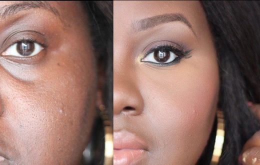 How to conceal dark circles