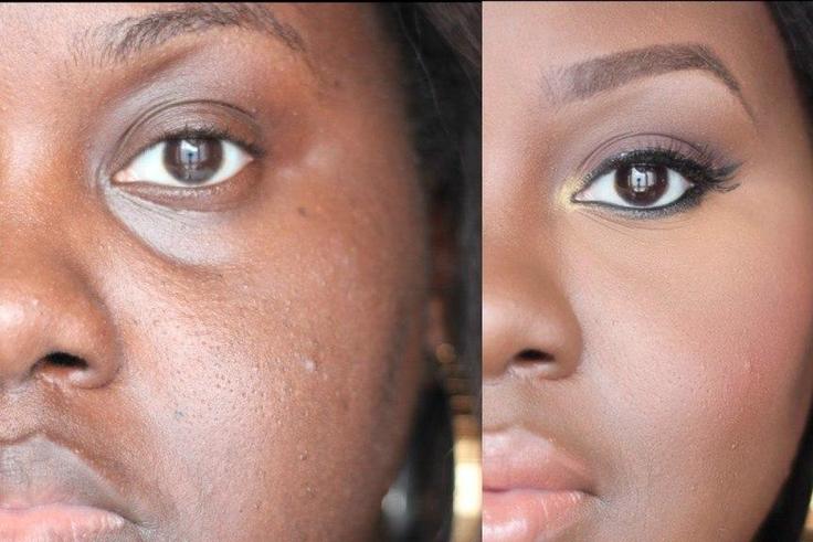 How to conceal dark circles