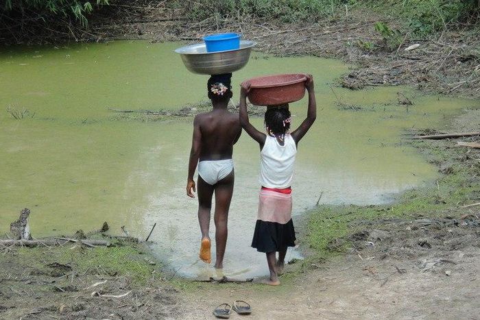 Buruli ulcer occurs mainly in areas close to stagnant water. Children under the age of 15 are often worst affected.