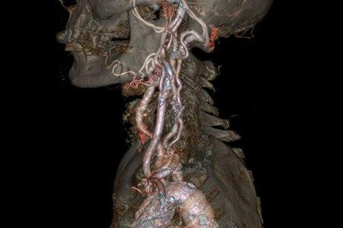 ___4623835___https:______static.pulse.com.gh___webservice___escenic___binary___4623835___2016___1___29___20___tumblr_inline_o1pqcs0wCL1sgr685_500