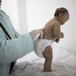 Brazil reports increase in microcephaly cases linked to Zika