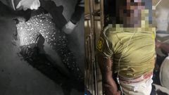 U/E: 2 Ghana immigration officers ambushed and shot at Nagani