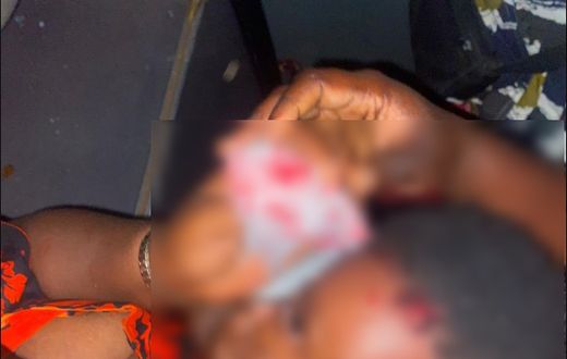 An injured child from the attack on Asantehene's convoy