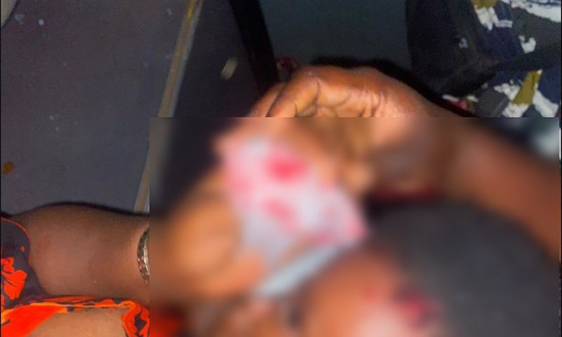 An injured child from the attack on Asantehene's convoy