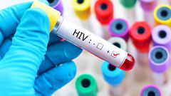 Ghana recorded 15,290 new HIV infections, 12,614 AIDS-related deaths in 2024 - National HIV Estimates