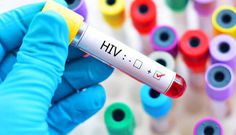 Ghana recorded 15,290 new HIV infections, 12,614 AIDS-related deaths in 2024 - National HIV Estimates