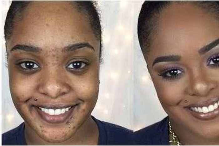 skin blemishes can be perfectly concealed with makeup