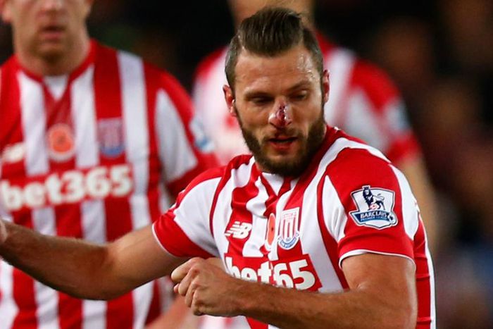 ___4489705___https:______static.pulse.com.gh___webservice___escenic___binary___4489705___2015___12___23___11___erikpieters-cropped_1hdqoramvm4o214t7d45ykpjx2