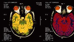Studies published this year shed light on the mysteries of the brain and human behavior, and began paving the way for new treatments to mental and neurological health problems, ranging from addiction to autism to Alzheimer's disease.
