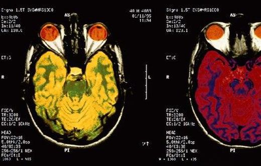 Studies published this year shed light on the mysteries of the brain and human behavior, and began paving the way for new treatments to mental and neurological health problems, ranging from addiction to autism to Alzheimer's disease.
