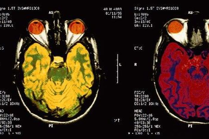 Studies published this year shed light on the mysteries of the brain and human behavior, and began paving the way for new treatments to mental and neurological health problems, ranging from addiction to autism to Alzheimer's disease.