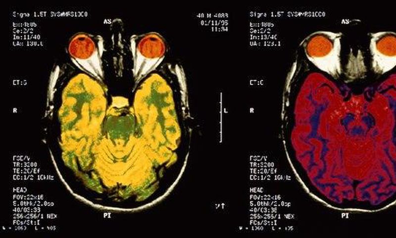 Studies published this year shed light on the mysteries of the brain and human behavior, and began paving the way for new treatments to mental and neurological health problems, ranging from addiction to autism to Alzheimer's disease.