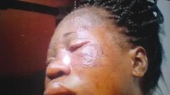 An injured Chinwendu Nwobodo has also lost her first baby