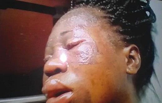 An injured Chinwendu Nwobodo has also lost her first baby