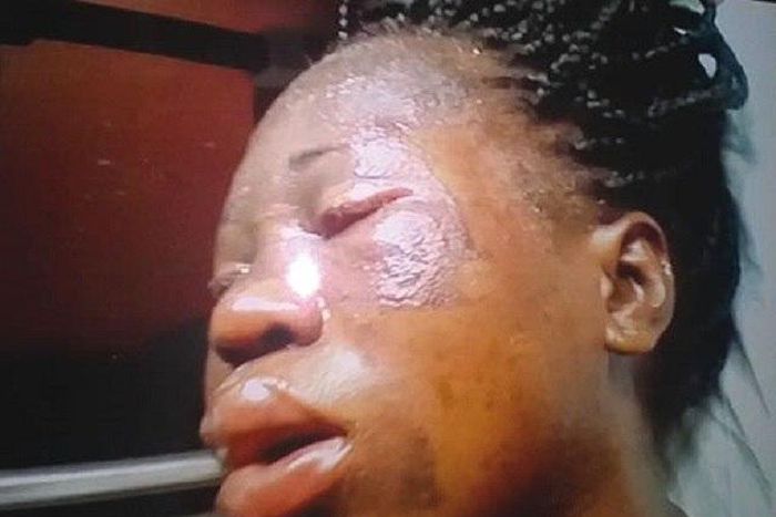 An injured Chinwendu Nwobodo has also lost her first baby