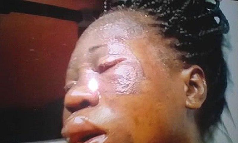 An injured Chinwendu Nwobodo has also lost her first baby