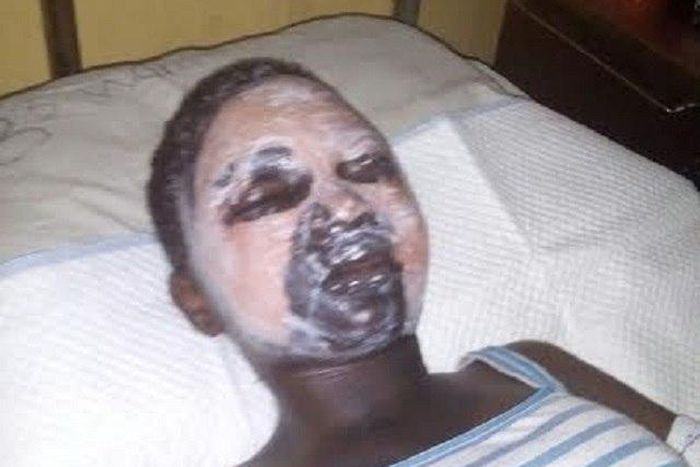 The scarred Adetayo Adefarasin