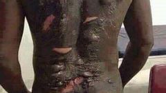 This man was bathed with hot water by his wife