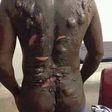 This man was bathed with hot water by his wife