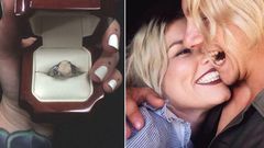 Man uses his wisdom tooth as engagement ring to propose to his fiancee
