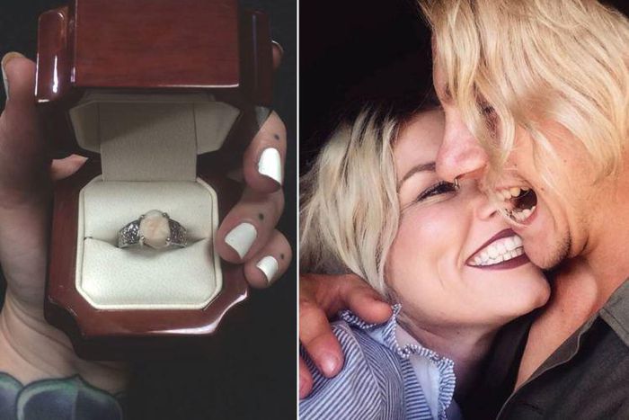 Man uses his wisdom tooth as engagement ring to propose to his fiancee