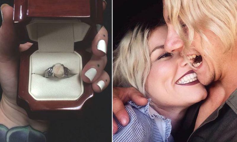 Man uses his wisdom tooth as engagement ring to propose to his fiancee