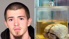 23-year-old man pleads guilty to stealing human brains from museum