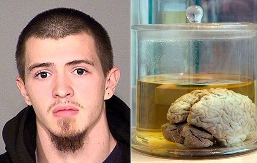 23-year-old man pleads guilty to stealing human brains from museum