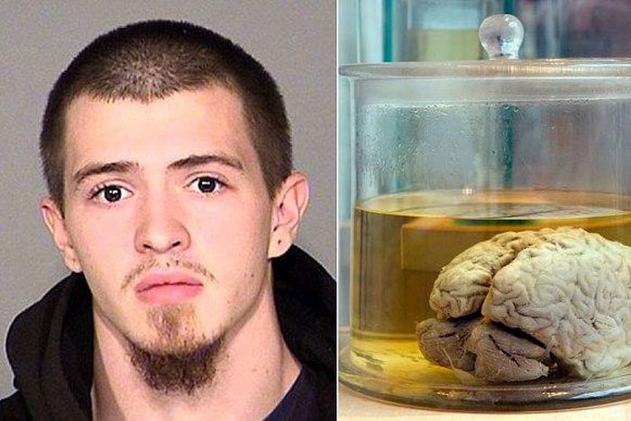 23-year-old man pleads guilty to stealing human brains from museum