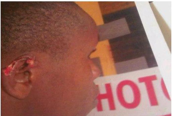 ___4295743___https:______static.pulse.com.gh___webservice___escenic___binary___4295743___2015___10___26___16___Prostitute+bites