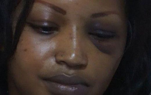 The disfigured face of Ruth Gakii