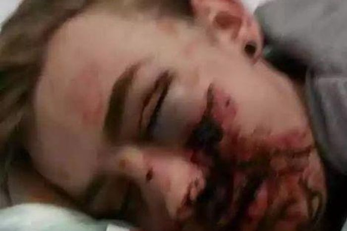 Danny Beardmore after being attacked at night