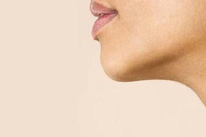 Facial hair can be removed with simple home remedies