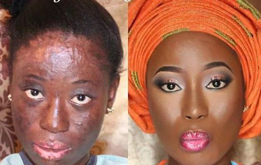 How A Makeup Artist Transformed Gas Explosion Survivor