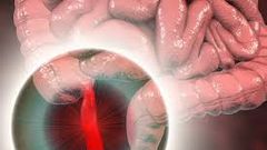 Did you know that you can survive without some of your human organs?
