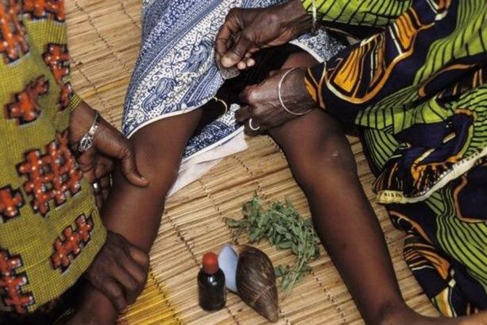 Female Genital Mutilation