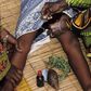 Female Genital Mutilation