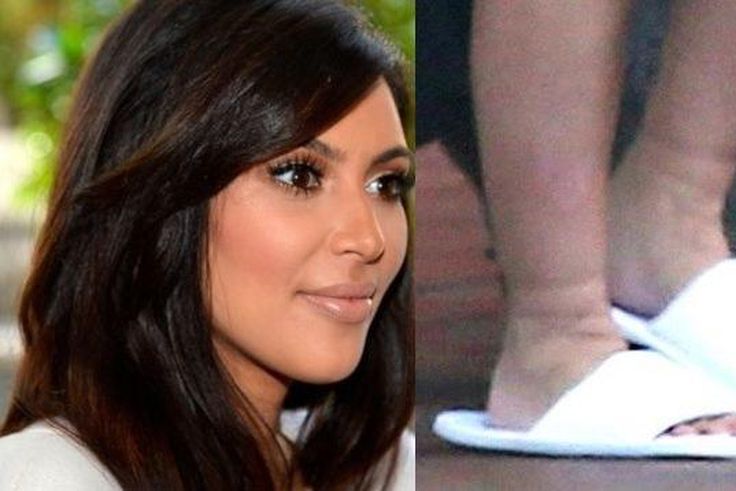 Kim Kardashian suffers swollen feet during 2nd pregnancy