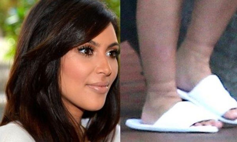 Kim Kardashian suffers swollen feet during 2nd pregnancy