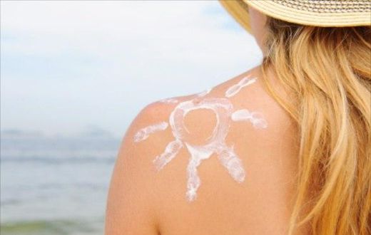 Sunburn