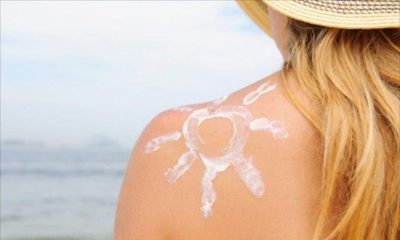 Sunburn