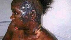This poor girl has been disfigured by a jealous wife