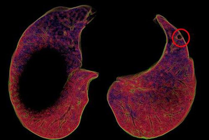 ___4231621___https:______static.pulse.com.gh___webservice___escenic___binary___4231621___2015___10___5___17___tumblr_inline_nutxg5ZLyS1qzgziy_500