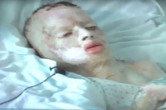 8-yr-old Robbie Middleton in a hospital bed after his attack