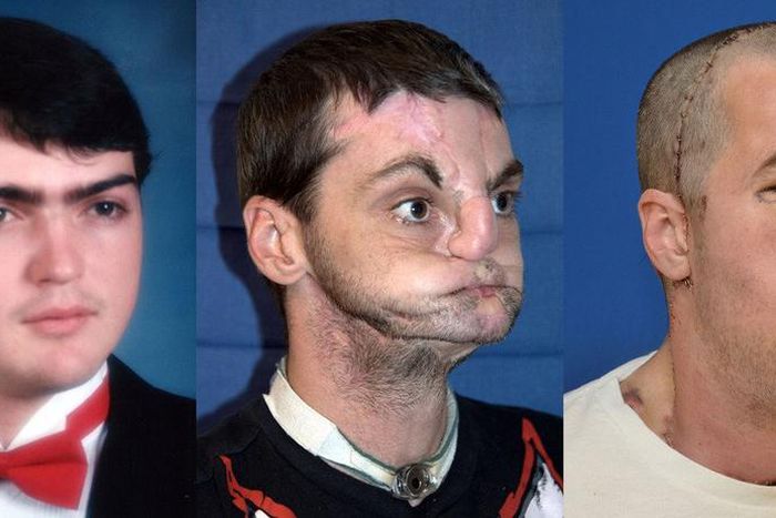 Stages of Richard's transformation