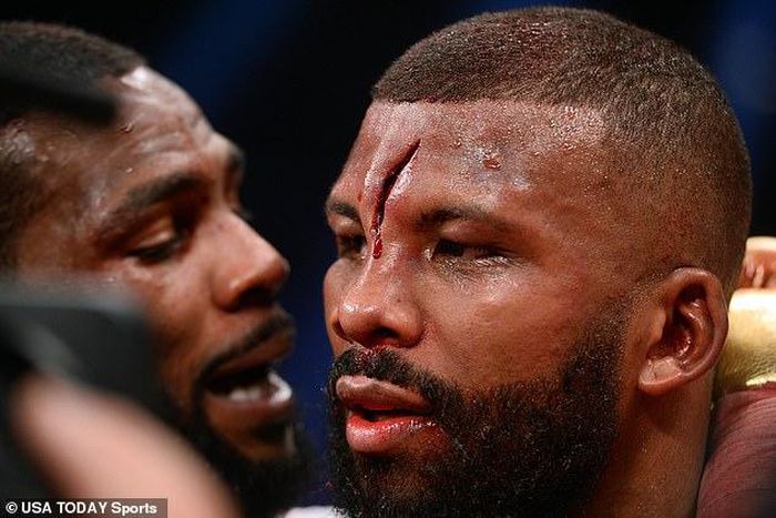 Badou Jack suffered a horrific head injury during his fight with Marcus Browne in Vegas