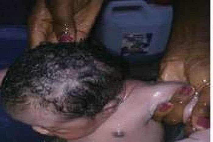 The baby rescued from th toilet